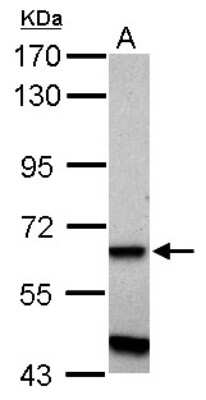 Western Blot: ZNF554 Antibody [NBP2-21026]