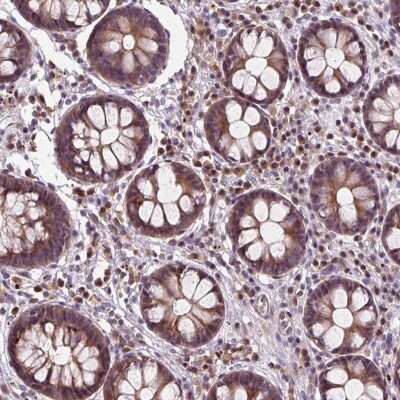 Immunohistochemistry: ZNF555 Antibody [NBP2-49182]