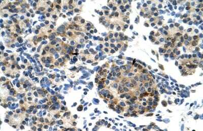 Immunohistochemistry-Paraffin: ZNF555 Antibody [NBP1-80167]