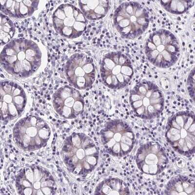 Immunohistochemistry-Paraffin: ZNF555 Antibody [NBP2-49106]