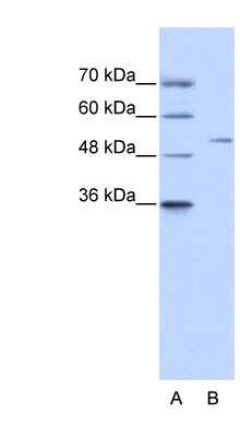 Western Blot: ZNF555 Antibody [NBP1-80166]