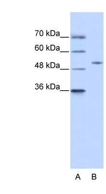 Western Blot: ZNF555 Antibody [NBP1-80167]