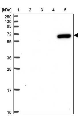 Western Blot: ZNF555 Antibody [NBP2-49106]