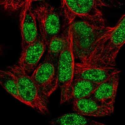 Immunocytochemistry/ Immunofluorescence: ZNF556 Antibody [NBP2-56019]