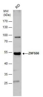 Western Blot: ZNF556 Antibody [NBP2-43598]