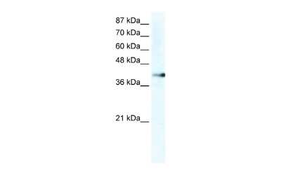 Western Blot: ZNF556 Antibody [NBP2-86515]