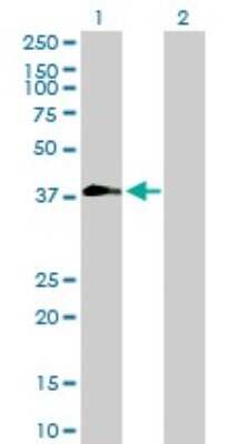 Western Blot: ZNF557 Antibody [H00079230-B01P]