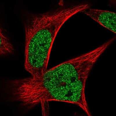 Immunocytochemistry/ Immunofluorescence: ZNF559 Antibody [NBP2-31787]