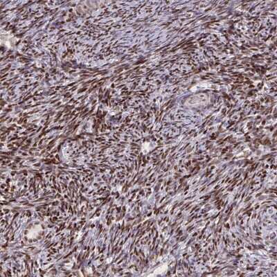 Immunohistochemistry-Paraffin: ZNF559 Antibody [NBP2-31787]