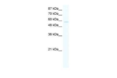 Western Blot: ZNF559 Antibody [NBP2-86516]