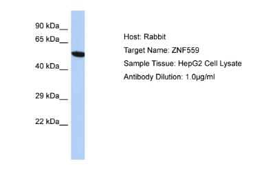 Western Blot: ZNF559 Antibody [NBP2-86517]