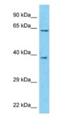 Western Blot: ZNF559-ZNF177 Antibody [NBP3-09196]