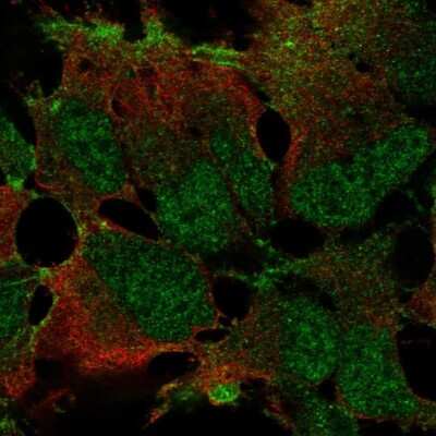 Immunocytochemistry/ Immunofluorescence: ZNF560 Antibody [NBP2-68804]