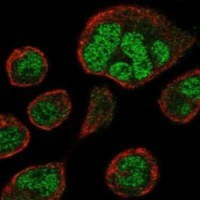 Immunocytochemistry/ Immunofluorescence: ZNF560 Antibody [NBP3-17461]