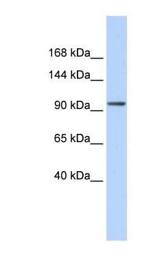 Western Blot: ZNF560 Antibody [NBP1-80161]