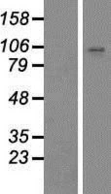 Western Blot: ZNF560 Overexpression Lysate [NBP2-05366]