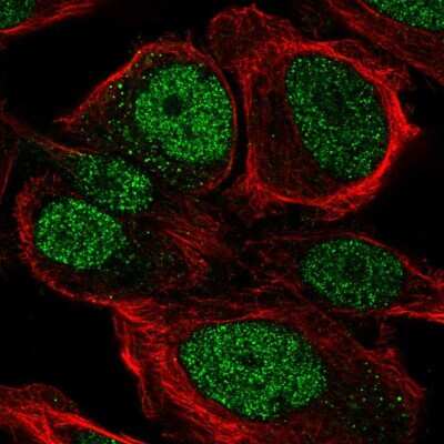 Immunocytochemistry/ Immunofluorescence: ZNF561 Antibody [NBP2-55939]