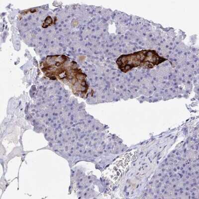 Immunohistochemistry-Paraffin: ZNF561 Antibody [NBP2-33749]