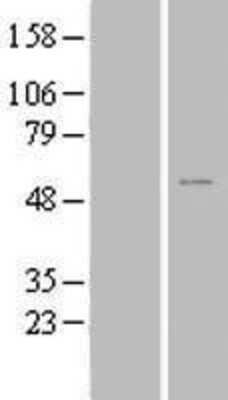 Western Blot: ZNF561 Overexpression Lysate [NBL1-18186]