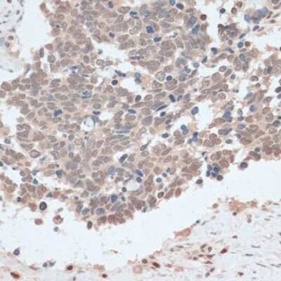 Immunohistochemistry-Paraffin: ZNF562 Antibody - Azide and BSA Free [NBP3-04480]