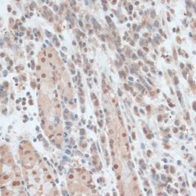 Immunohistochemistry-Paraffin: ZNF562 Antibody - Azide and BSA Free [NBP3-04480]