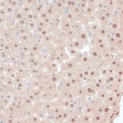 Immunohistochemistry-Paraffin: ZNF562 Antibody - Azide and BSA Free [NBP3-04480]