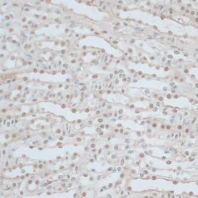 Immunohistochemistry-Paraffin: ZNF562 Antibody - Azide and BSA Free [NBP3-04480]