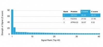 Protein Array: ZNF562 Antibody (PCRP-ZNF562-1A1)Azide and BSA Free [NBP3-14150]