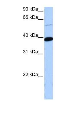 Western Blot: ZNF562 Antibody [NBP1-79456]