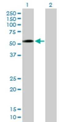 Western Blot: ZNF563 Antibody [H00147837-B01P]