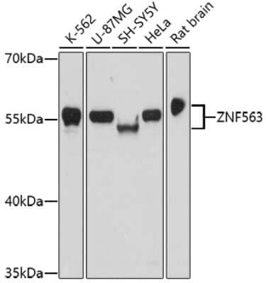 Western Blot: ZNF563 AntibodyAzide and BSA Free [NBP2-93199]