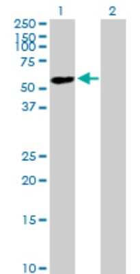 Western Blot: ZNF565 Antibody [H00147929-B01P]