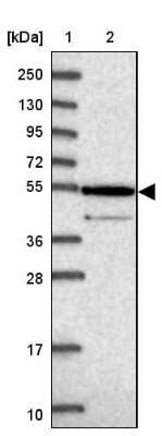 Western Blot: ZNF565 Antibody [NBP1-81951]