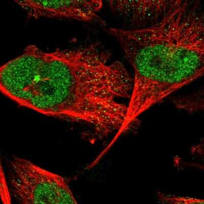 Immunocytochemistry/ Immunofluorescence: ZNF566 Antibody [NBP1-82222]