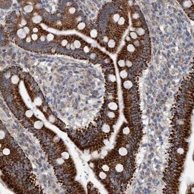 Immunohistochemistry-Paraffin: ZNF566 Antibody [NBP1-82222]