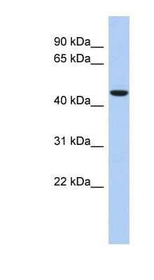 Western Blot: ZNF566 Antibody [NBP1-80126]