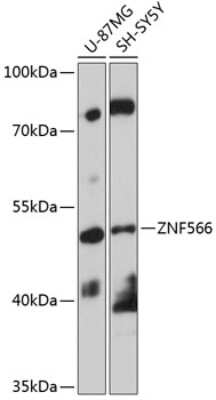 Western Blot: ZNF566 AntibodyBSA Free [NBP2-94217]