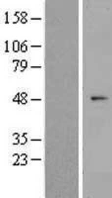 Western Blot: ZNF566 Overexpression Lysate [NBL1-18190]