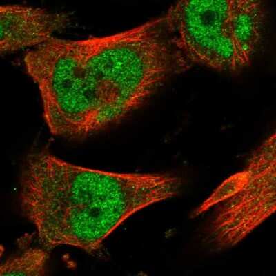 Immunocytochemistry/ Immunofluorescence: ZNF567 Antibody [NBP1-81070]