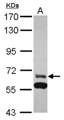 Western Blot: ZNF567 Antibody [NBP2-21027]