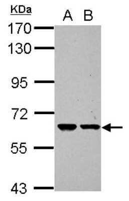 Western Blot: ZNF567 Antibody [NBP2-21028]