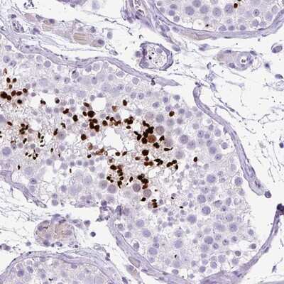 Immunohistochemistry-Paraffin: ZNF568 Antibody [NBP2-13581]