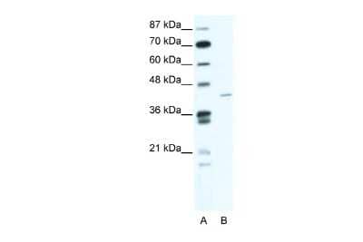 Western Blot: ZNF568 Antibody [NBP2-83870]