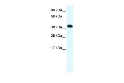 Western Blot: ZNF568 Antibody [NBP2-83871]