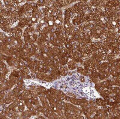 Immunohistochemistry-Paraffin: ZNF569 Antibody [NBP2-30747]