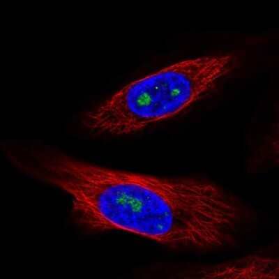 Immunocytochemistry/ Immunofluorescence: ZNF57 Antibody [NBP2-56710]