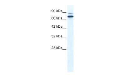 Western Blot: ZNF57 Antibody [NBP2-83875]