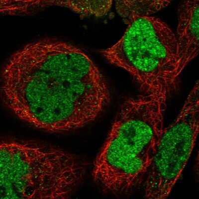 Immunocytochemistry/ Immunofluorescence: ZNF570 Antibody [NBP1-82035]