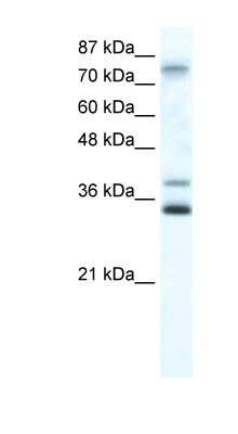 Western Blot: ZNF570 Antibody [NBP1-80143]