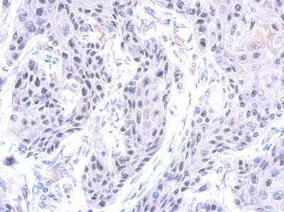Immunohistochemistry-Paraffin: ZNF571 Antibody [NBP2-15176]